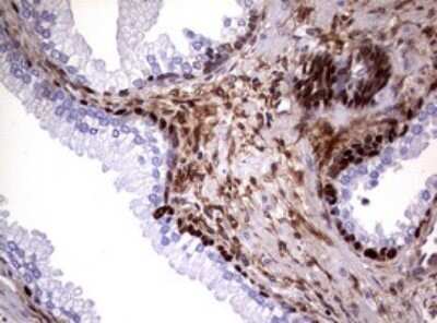 Immunohistochemistry: Glutathione S-Transferase pi 1/GSTP1 Antibody (OTI4B6) - Azide and BSA Free [NBP2-70857] - Analysis of Human prostate tissue. (Heat-induced epitope retrieval by 10mM citric buffer, pH6.0, 120C for 3min)