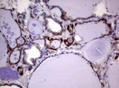 Immunohistochemistry: Glutathione S-Transferase pi 1/GSTP1 Antibody (OTI4B6) - Azide and BSA Free [NBP2-70857] - Analysis of Human thyroid tissue. (Heat-induced epitope retrieval by 10mM citric buffer, pH6.0, 120C for 3min)