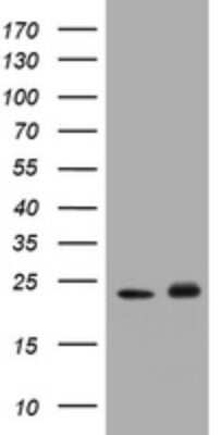 Western Blot: Glutathione S-Transferase pi 1/GSTP1 Antibody (OTI4B6) - Azide and BSA Free [NBP2-70857] - Analysis of HEK293T cells were transfected with the pCMV6-ENTRY control (Left lane) or pCMV6-ENTRY GSTP1.