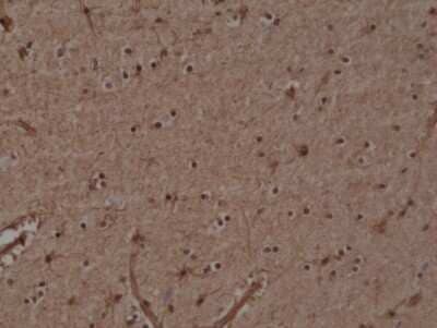 Immunohistochemistry: Glutathione S-Transferase pi 1/GSTP1 Antibody (RM347) [NBP2-77420] - Immunohistochemical staining of formalin fixed and paraffin embedded human Brain tissue section using NBP2-77420.