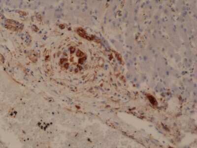 Immunohistochemistry: Glutathione S-Transferase pi 1/GSTP1 Antibody (RM347) [NBP2-77420] - Immunohistochemical staining of formalin fixed and paraffin embedded human Liver tissue section using NBP2-77420.