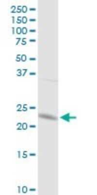 Western Blot: Glutathione S-Transferase pi 1/GSTP1 Antibody [H00002950-D01P] - Analysis of GSTP1 expression in HeLa.