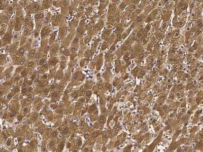 Immunohistochemistry-Paraffin: Glutathione S-transferase Mu 5 Antibody [NBP2-97064] - Immunochemical staining of human GSTM5 in human liver with rabbit polyclonal antibody at 1:5000 dilution, formalin-fixed paraffin embedded sections.