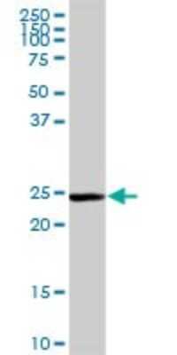Western Blot: Glutathione S-transferase Mu 5 Antibody [H00002949-D01P] - Analysis of GSTM5 expression in mouse liver.