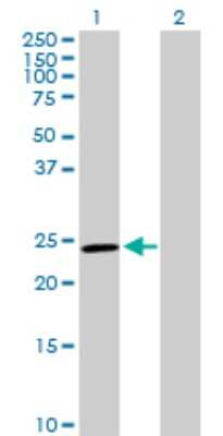 Western Blot: Glutathione S-transferase Mu 5 Antibody [H00002949-D01P] - Analysis of GSTM5 expression in transfected 293T cell line by GSTM5 polyclonal antibody.Lane 1: GSTM5 transfected lysate(25.70 KDa).Lane 2: Non-transfected lysate.
