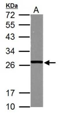 Western Blot: Glutathione S-transferase Mu 5 Antibody [NBP2-16687] - Sample (50 ug of whole cell lysate) A: Mouse Brain, 12% SDS PAGE gel, diluted at 1:1000.