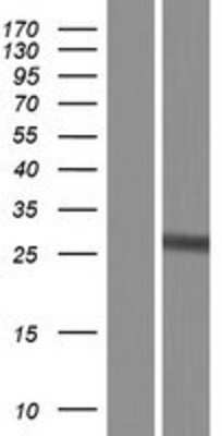 Western Blot: Glutathione S-transferase Mu 5 Overexpression Lysate (Adult Normal) [NBP2-10709] Left-Empty vector transfected control cell lysate (HEK293 cell lysate); Right -Over-expression Lysate for Glutathione S-transferase Mu 5.