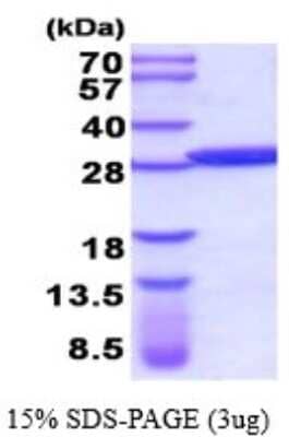 SDS-Page: Recombinant Human Glutathione S-transferase Mu 5 Protein [NBP2-52145] - 15% SDS Page (3 ug)