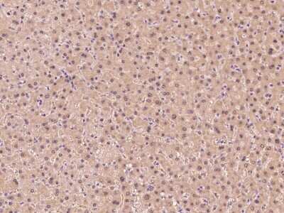 Immunohistochemistry-Paraffin: Glutathione Synthetase Antibody [NBP2-99590] - Immunochemical staining of human Glutathione Synthetase in human kidney with rabbit polyclonal antibody at 1:1000 dilution, formalin-fixed paraffin embedded sections.