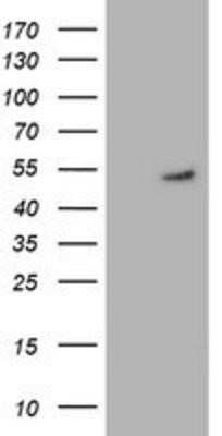 Western Blot: Glutathione Synthetase Antibody (OTI1B8) - Azide and BSA Free [NBP2-70854] - HEK293T cells were transfected with the pCMV6-ENTRY control (Left lane) or pCMV6-ENTRY Glutathione Synthetase (Right lane) cDNA for 48 hrs and lysed. Equivalent amounts of cell lysates (5 ug per lane) were separated by SDS-PAGE and immunoblotted with anti