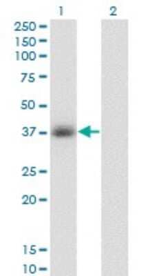 Western Blot: Glycerol 3 Phosphate Dehydrogenase Antibody (3C10-1C4) [H00002819-M01] - Analysis of GPD1 expression in transfected 293T cell line by GPD1 monoclonal antibody (M01), clone 3C10-1C4.Lane 1: GPD1 transfected lysate (Predicted MW: 37.6 KDa).Lane 2: Non-transfected lysate.