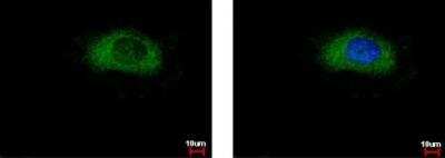 Immunocytochemistry/Immunofluorescence: Glycerol 3 Phosphate Dehydrogenase Antibody [NBP2-53091] - HeLa cells were fixed in 4% paraformaldehyde at RT for 15 min. Green: GPD1 protein stained by GPD1 antibody diluted at 1:500. Blue: Hoechst 33343 staining.