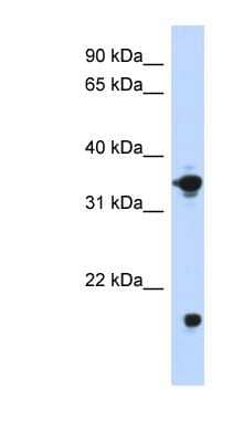 Western Blot: Glycerol 3 Phosphate Dehydrogenase Antibody [NBP1-55332] - Titration: 0.2-1 ug/ml, Positive Control: Transfected 293T.