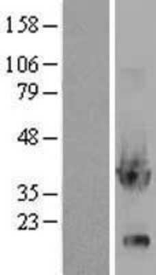 Western Blot: Glycerol 3 Phosphate Dehydrogenase Overexpression Lysate (Adult Normal) [NBL1-11224] Left-Empty vector transfected control cell lysate (HEK293 cell lysate); Right -Over-expression Lysate for Glycerol 3 Phosphate Dehydrogenase.