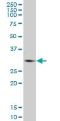 Western Blot: Glycine N-Methyltransferase/GNMT Antibody [H00027232-B01P] - Analysis of GNMT expression in human liver.