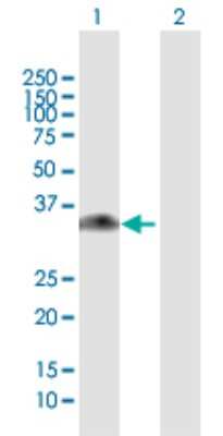 Western Blot: Glycine N-Methyltransferase/GNMT Antibody [H00027232-B01P] - Analysis of GNMT expression in transfected 293T cell line by GNMT polyclonal antibody.  Lane 1: GNMT transfected lysate(32.45 KDa). Lane 2: Non-transfected lysate.