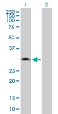 Western Blot: Glycine N-Methyltransferase/GNMT Antibody [H00027232-D01P] - Analysis of GNMT expression in transfected 293T cell line by GNMT polyclonal antibody.Lane 1: GNMT transfected lysate(32.70 KDa).Lane 2: Non-transfected lysate.