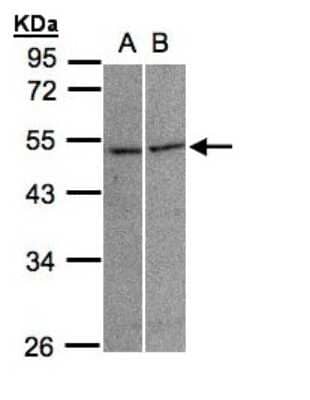 Western Blot Glycine Receptor alpha 3 Antibody - BSA Free