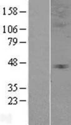 Western Blot: Glycine Receptor alpha 3 Overexpression Lysate (Adult Normal) [NBP2-04313] Left-Empty vector transfected control cell lysate (HEK293 cell lysate); Right -Over-expression Lysate for Glycine Receptor alpha 3.