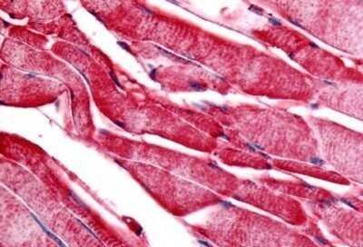 Immunohistochemistry-Paraffin: Glycogen phosphorylase, muscle form Antibody [NB100-58762] - Analysis of anti-PYGM / Phosphorylase b antibody with human skeletal muscle at concentration 20 ug/ml.