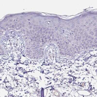 Immunohistochemistry-Paraffin Glycogen phosphorylase, muscle form Antibody