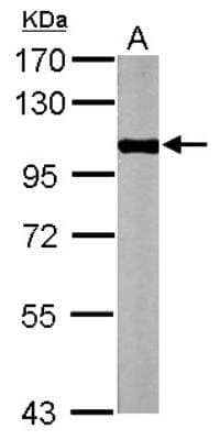 Western Blot: Glycogen phosphorylase, muscle form Antibody [NBP2-16689] - Sample (50 ug of whole cell lysate) A: Mouse brain 7.5% SDS PAGE  diluted at 1:1000