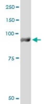 Western Blot Glycogen phosphorylase, muscle form Antibody (2C4)