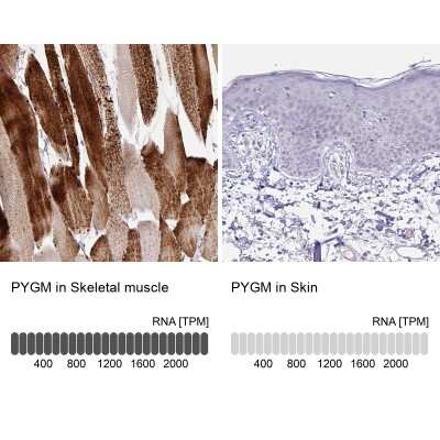 <b>Orthogonal Strategies Validation. </b>Immunohistochemistry-Paraffin: Glycogen phosphorylase, muscle form Antibody [NBP2-49209] - Staining in human skeletal muscle and skin tissues using anti-PYGM antibody. Corresponding PYGM RNA-seq data are presented for the same tissues.