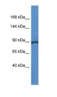 Western Blot: Glycogen phosphorylase, muscle form Antibody [NBP1-74149] - Titration: 1.0 ug/ml Positive Control: Mouse Heart.