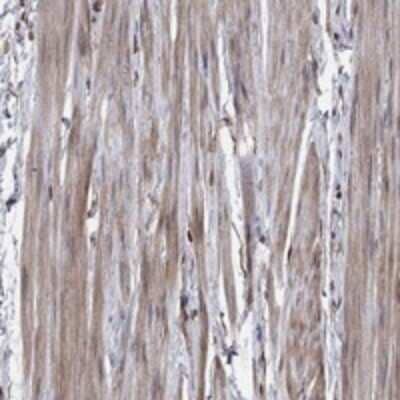 Immunohistochemistry-Paraffin Glycogenin 1 Antibody - BSA Free