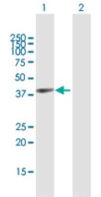 Western Blot: Glycogenin 1 Antibody [H00002992-B01P] - Analysis of GYG1 expression in transfected 293T cell line by GYG1 polyclonal antibody.  Lane 1: GYG1 transfected lysate(36.63 KDa). Lane 2: Non-transfected lysate.