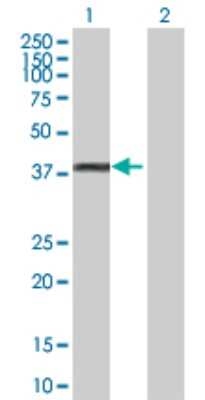 Western Blot: Glycogenin 1 Antibody [H00002992-D01P] - Analysis of GYG1 expression in transfected 293T cell line by GYG1 polyclonal antibody.Lane 1: GYG1 transfected lysate(37.50 KDa).Lane 2: Non-transfected lysate.