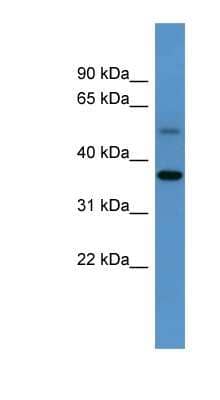 Western Blot: Glycogenin 1 Antibody [NBP1-79291] - Mouse Kidney lysate, concentration 0.2-1 ug/ml.
