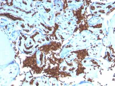 Immunohistochemistry-Paraffin: Glycophorin A Antibody (GYPA/3219R) - Azide and BSA Free [NBP3-08261] - Formalin-fixed, paraffin-embedded human Placenta stained with Glycophorin A Recombinant Rabbit Monoclonal Antibody (GYPA/3219R).
