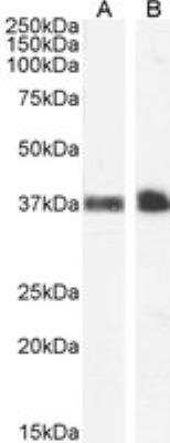 Western Blot: Glycophorin A Antibody [NB100-2428] - Staining of Human Peripheral Blood Monocytes (A) and Kidney (B) lysate (35 ug protein in RIPA buffer). Antibody at 1 ug/mL. Detected by chemiluminescence.