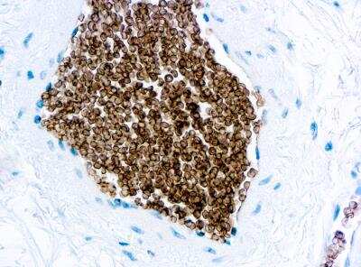 Immunohistochemistry-Paraffin: Glycophorin C Antibody (Ret40f) [NBP1-22548] - Formalin fixed paraffin embedded human tonsil stained with Glycophorin C antibody (NBP1-22548).