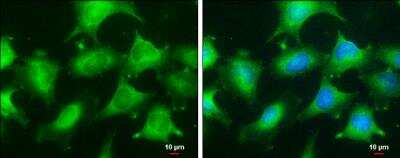 <b>Genetic Strategies Validation. </b>Immunocytochemistry/Immunofluorescence: Glyoxalase I Antibody (266) [NBP2-43618] - Glyoxalase I Antibody (266) detects Glyoxalase I protein at cytoplasm by immunofluorescent analysis. Sample: HeLa cells were fixed in 4% paraformaldehyde at RT for 15 min. Green: Glyoxalase I stained by Glyoxalase I Antibody (266) diluted at 1:100. Blue: Hoechst 33342 staining. Scale bar= 10 um.