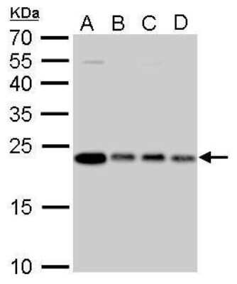 Western Blot: Glyoxalase I Antibody (266) [NBP2-43618] - Analysis of A. 30 ug 293T whole cell lysate/extract B. 30 ug HeLa whole cell lysate/extract C. 30 ug HepG2 whole cell lysate/extract D. 30 ug A375 whole cell lysate/extract 12 % SDS-PAGE Glyoxalase I antibody [266] dilution: 1:1000.