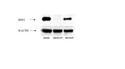 Western Blot: Glyoxalase I Antibody (Glo1a) [NBP1-19015] - Detection of GLO-1 in human cell lines. Lane 1,2 and 3: MG-63 osteosarcoma cell line (positive control), 402-91 liposarcoma cell line and 402-91 liposarcoma cell line resistant to trabectedine. Image from verified customer review.