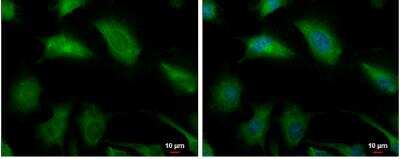 Immunocytochemistry/Immunofluorescence: Glyoxalase I Antibody [NBP1-31466] - HeLa cells were fixed in 4% paraformaldehyde at RT for 15 min. Green: Glyoxalase I protein stained by Glyoxalase I antibody [N1C3] diluted at 1:500. Blue: Hoechst 33342 staining. Scale bar = 10 um.