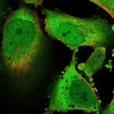 Immunocytochemistry/Immunofluorescence: Glyoxalase I Antibody [NBP2-56695] - Staining of human cell line U-251 MG shows localization to nucleoplasm, plasma membrane & cytosol.