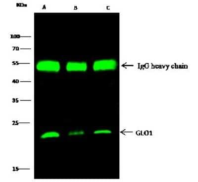 Immunoprecipitation: Glyoxalase I Antibody [NBP2-98271] - Mouse Glyoxalase I was immunoprecipitated using: Lane A: 0.5 mg 293T Whole Cell Lysate. Lane B: 0.5 mg A549 Whole Cell Lysate. Lane C: 0.5 mg HepG2 Whole Cell Lysate. 2 ul anti-Mouse Glyoxalase I rabbit polyclonal antibody and 15 ul of 50 % Protein G agarose. Primary antibody: Anti-Mouse Glyoxalase I rabbit polyclonal antibody, at 1:200 dilution. Secondary antibody: Dylight 800-labeled antibody to rabbit IgG (H+L), at 1:5000 dilution. Developed using the Odyssey technique. Performed under reducing conditions. Predicted band size: 24 kDa. Observed band size: 24 kDa