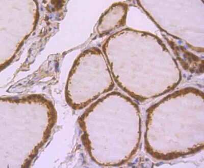 Immunohistochemistry-Paraffin: Glyoxalase I Antibody (JU44-11) [NBP2-75514] - Analysis of paraffin-embedded human thyroid gland tissue using anti-GLO1 antibody. Counter stained with hematoxylin.