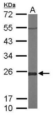 Western Blot: Glyoxalase I Antibody [NBP1-31466] - Sample (50 ug of whole cell lysate) A: Mouse brain 12% SDS PAGE; antibody diluted at 1:1000.