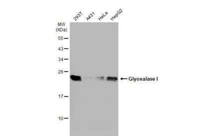 Western Blot: Glyoxalase I Antibody [NBP1-31466] - Various whole cell extracts (30 ug) were separated by 12% SDS-PAGE, and the membrane was blotted with Glyoxalase I antibody [N1C3] diluted at 1:1000. The HRP-conjugated anti-rabbit IgG antibody (NBP2-19301) was used to detect the primary antibody, and the signal was developed with Trident ECL plus-Enhanced.