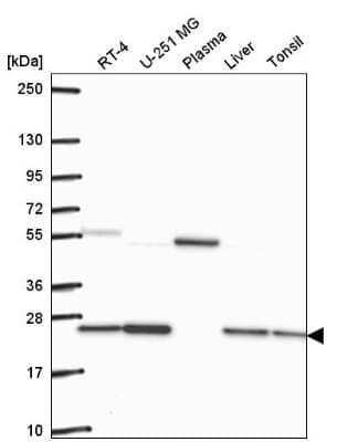 Western Blot: Glyoxalase I Antibody [NBP2-56695] - Western blot analysis in human cell line RT-4, human cell line U-251 MG, human plasma, human liver tissue and human tonsil tissue.