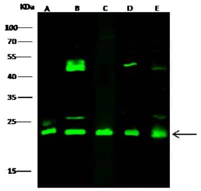 Western Blot: Glyoxalase I Antibody [NBP2-98271] - Anti-Glyoxalase I rabbit polyclonal antibody at 1:500 dilution. Lane A: 293T Whole Cell Lysate. Lane B: MCF7 Whole Cell Lysate. Lane C: A549 Whole Cell Lysate. Lysates/proteins at 30 ug per lane. Secondary Goat Anti-Rabbit IgG H&L (Dylight 800) at 1/10000 dilution. Developed using the Odyssey technique. Performed under reducing conditions. Predicted band size: 21 kDa. Observed band size: 23 kDa (We are unsure as to the identity of these extra bands).