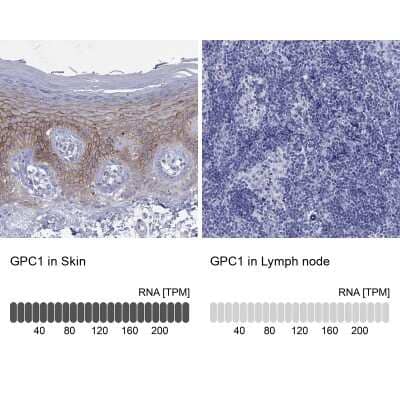 Immunocytochemistry/Immunofluorescence: Glypican 1 Antibody [NBP3-17035] - Analysis in human skin and lymph node tissues using Anti-GPC1 antibody. Corresponding GPC1 RNA-seq data are presented for the same tissues.