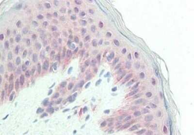 Immunohistochemistry: Glypican 1 Antibody [NBP1-42718] - Tissue: skin. Fixation: formalin fixed paraffin embedded. Primary antibody: anti-Glypican antibody at 10 ug/mL for 1 h at RT. Secondary antibody: Peroxidase rabbit secondary antibody at 1:10,000 for 45 min at RT. Staining: Glypican as precipitated red signal with hematoxylin purple nuclear counterstain.