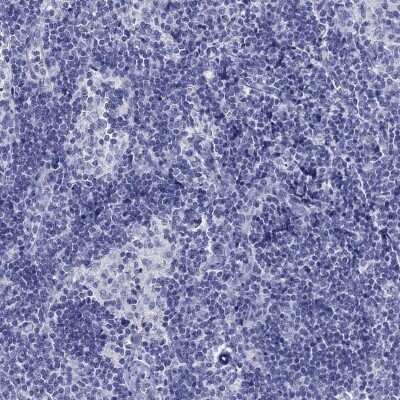 Immunohistochemistry-Paraffin: Glypican 1 Antibody [NBP3-17035] - Staining of human lymph node shows low expression as expected.